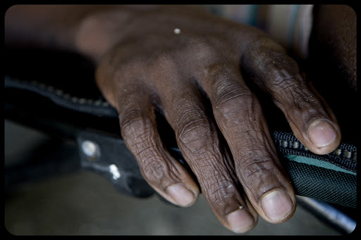 Patient &#8211; Sick &#8211; Hand © UNICEF-Marco Dormino &#8211; it