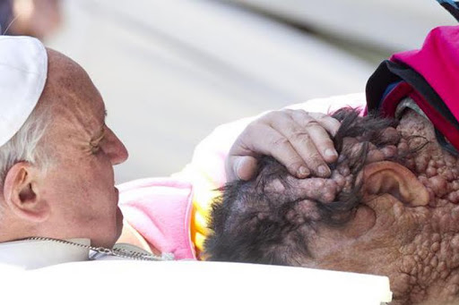 Pope Francis embraces disfigured Vicinio Rivas &#8211; it