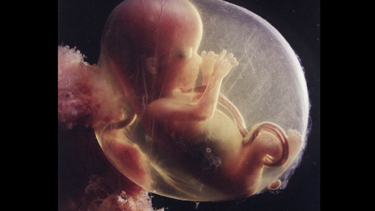 Foetus – fr