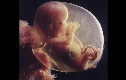 Foetus – fr
