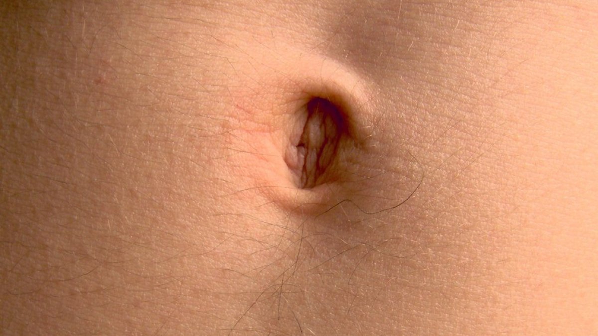 ombelico