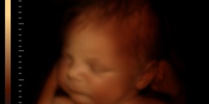 Sono un uomo e sono pro life. L&#8217;aborto è anche &#8220;affar mio&#8221;!