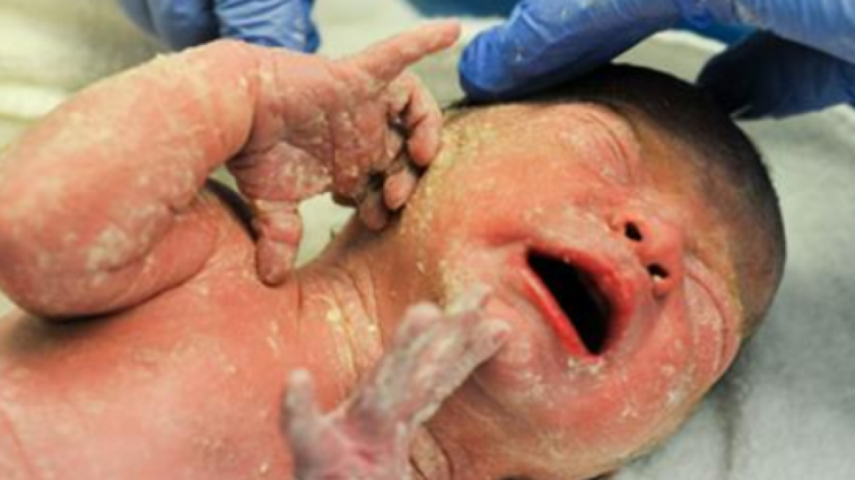 BAMBINO, PARTO, MIRACOLO