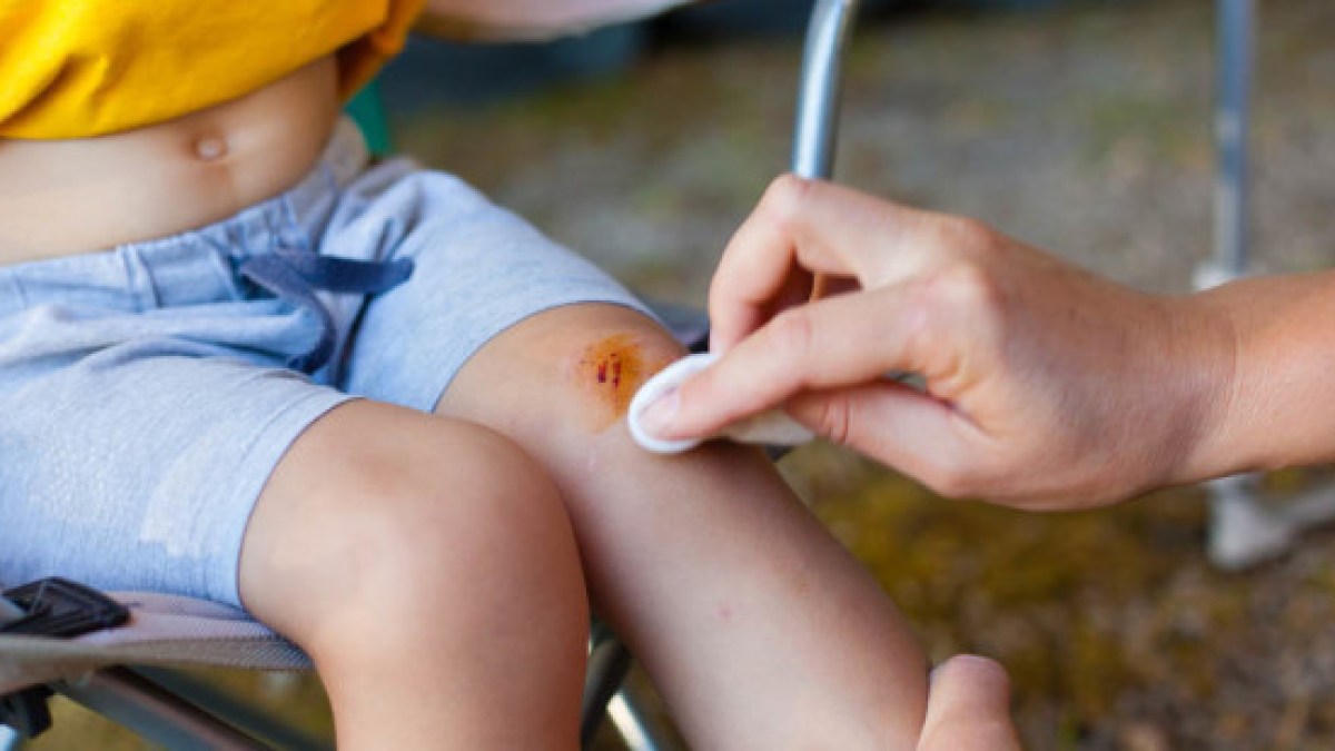 web3-mother-child-wound-bandage-injury-knee-shutterstock_360971015-by-rades-ai
