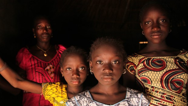 FGM