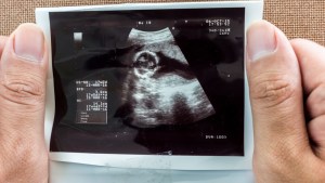 MAN,ULTRASOUND