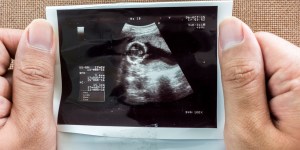 Kentucky: i medici abortisti dovranno mostrare alle mamme le ecografie dei loro bambini