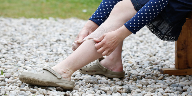 web3-woman-pain-legs-vascular-disease-shutterstock_524245147-zlikovec-ai