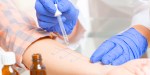 ALLERGY TEST