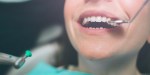 DENTISTA PULIZIA