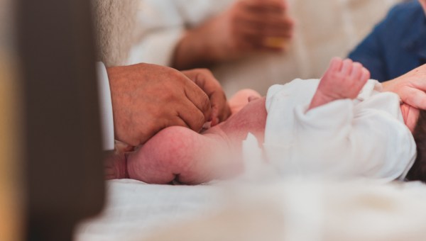 CIRCONCISIONE CERIMONIA EBRAICA