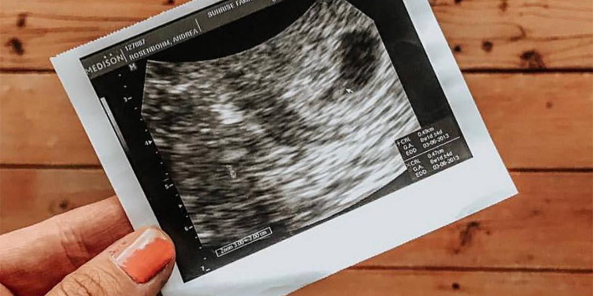 ULTRASOUND