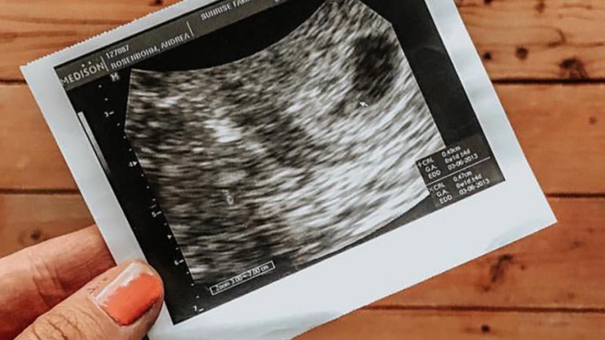 ULTRASOUND