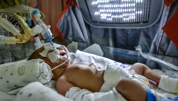 NEWBORN INTENSIVE CARE