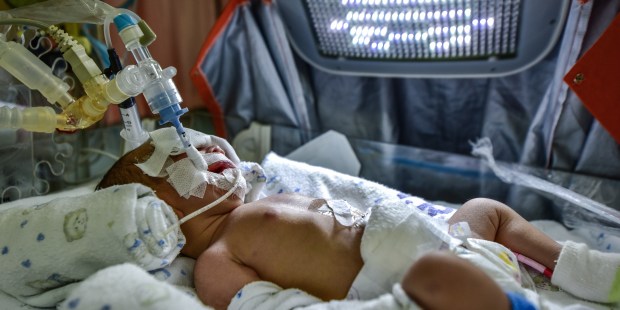 NEWBORN INTENSIVE CARE