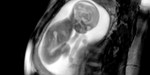 ULTRASOUND