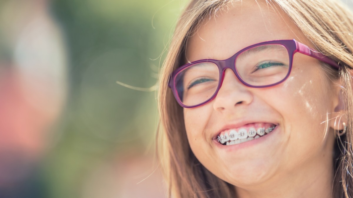 DENTAL BRACES