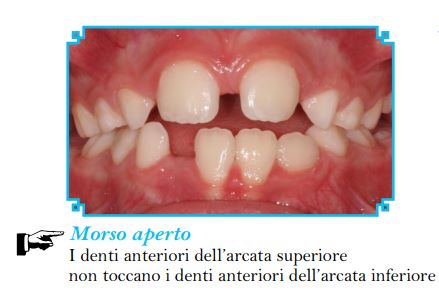 DENTI BAMBINI