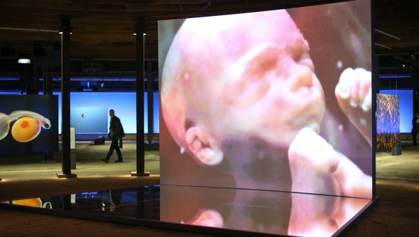 Lennart Nilsson EXHIBITION