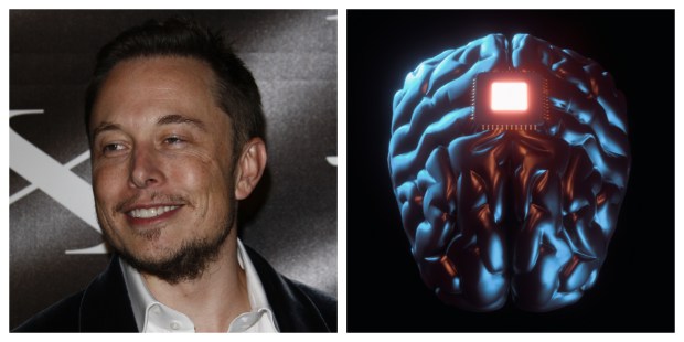 ELON MUSK, CHIP, BRAIN