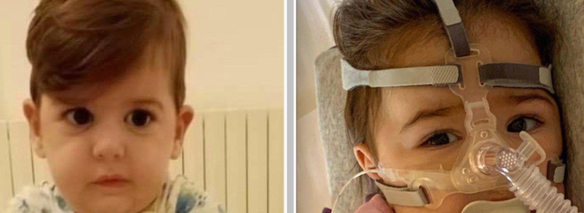raccolti fondi bambini affetti sma