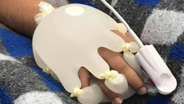 GLOVE