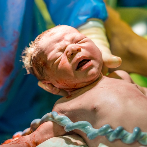 NEW BORN, CORDONE OMBELICALE