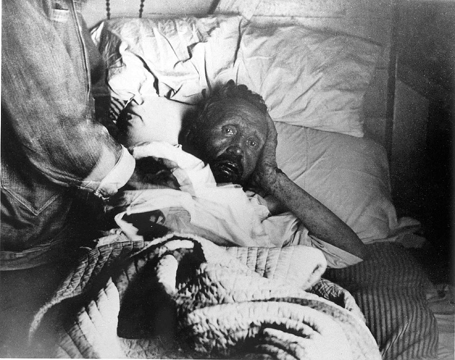 9_Father_Damien_on_his_deathbed_resting_on_his_side.jpeg