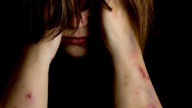 SELF-HARM,
