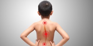 L&#8217;uso del corsetto per curare la scoliosi nei bambini