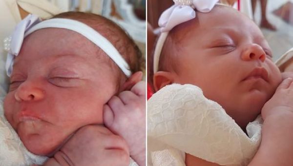 antes e depois do Batismo