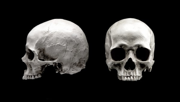 HUMAN SKULL
